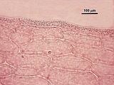 6 - Sezione ottica della zona corticale e delle cellule corticali interne